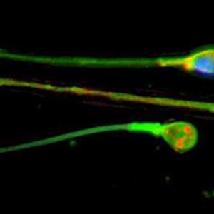 Deferol Climax Control For Men - Remedies For Premature Ejaculation - Increase Your Staying Power Starting Today! Deferol Climax Control For Men - Remedies For Premature Ejaculation - Increase Your Staying Power Starting Today!